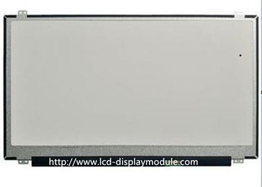 Módulo da exposição de TFT do quadrado do IPS da relação de MCU SPI para o Smart Watch Wearable
